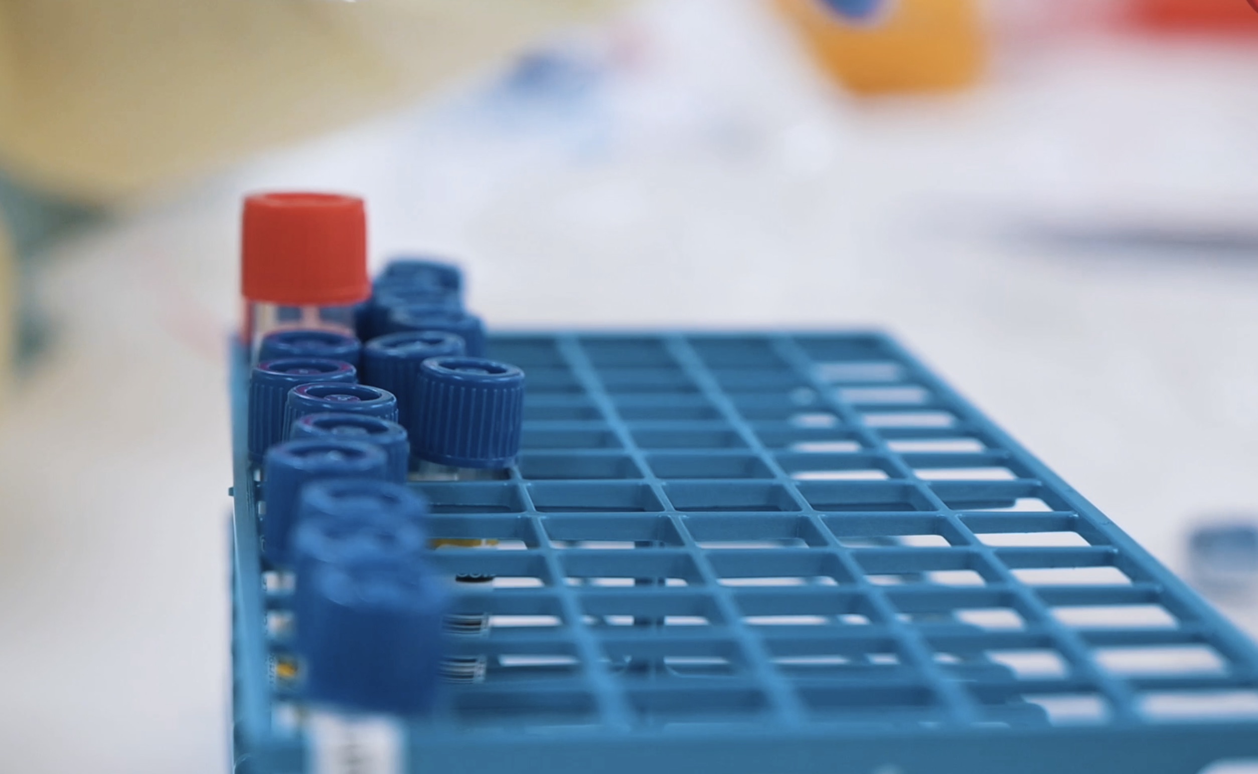 L’Institut de microbiologie du CHUV a ouvert ses portes à la presse.